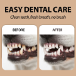 Picture of Naturé Disposable Dental Finger Wipes for Dogs and Cats (50 Wipes)